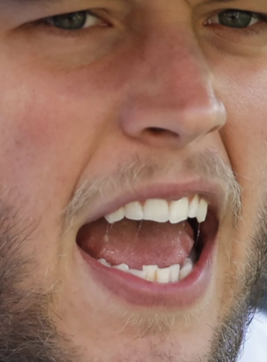 OzairOnceSaid's tweet photo. I love Matthew Stafford because he’s made a QUARTER BILLION DOLLARS and his bottom teeth are still more crowded than a Tokyo train. https://t.co/JmzAhkqMdN