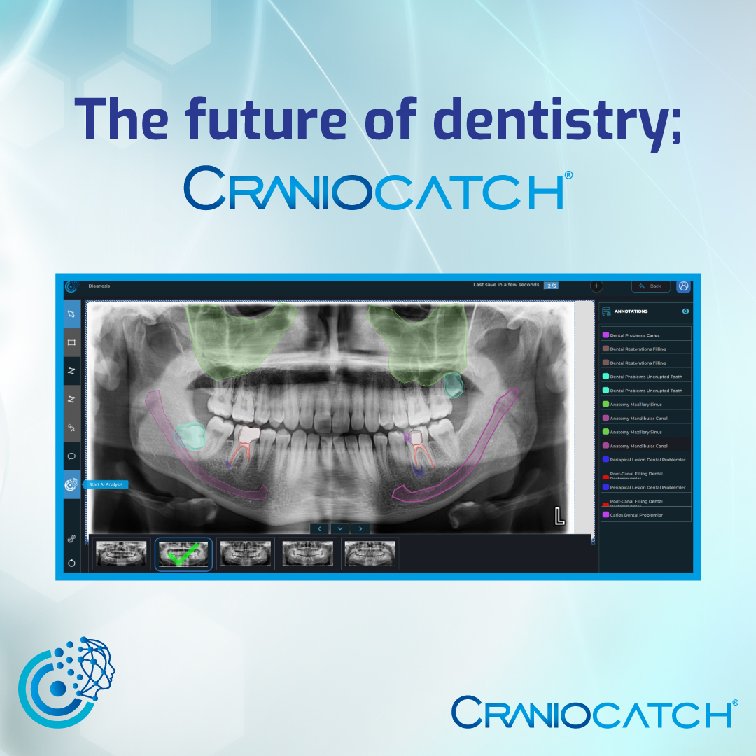 CranioCatch brings together new generation diagnostic methods to dentists and becomes the biggest helper in the treatment processes!

#dentistry #artificialintelligence #craniocatch