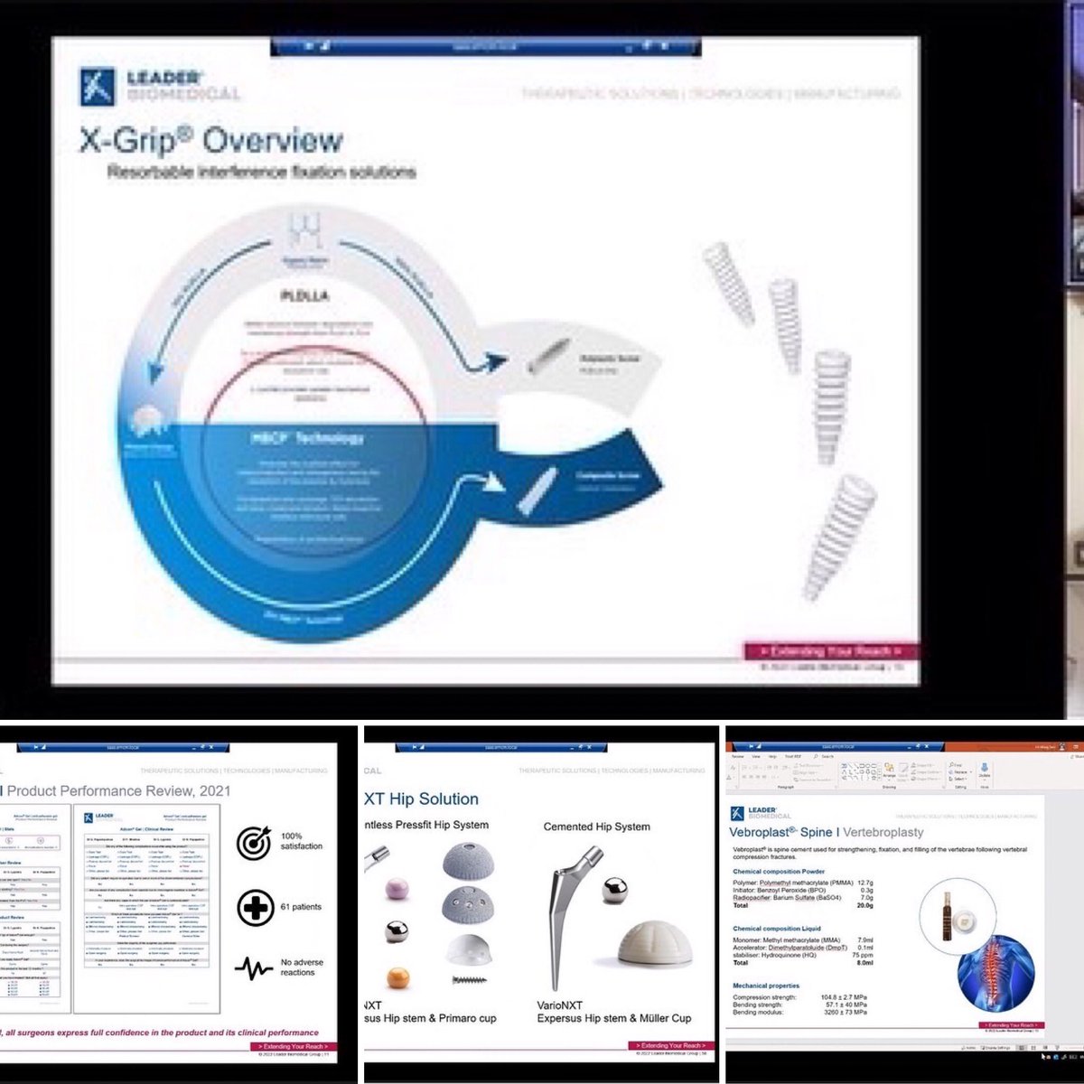 #customerservice #continuingeducation  #continuouslearning 
#alwayscurious #alwaysimproving #engaging #session2022  #joinedforces  #orientationsession #jointcare  #surgeries #aclreconstruction 
#hipsurgery #hipreplacement #spinesurgery 
learning@leaderbiomedical.com