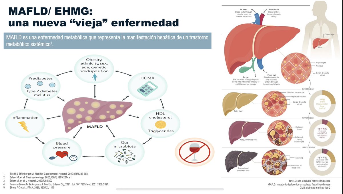 CristobMorales's tweet image. id.elsevier.com/ACW/?return=ht… MAFLD o Enfermedad Hepática Metabólica una epidemia oculta en nuestras consultas, una enfermedad sistémica que requiere un abordaje holístico y multidisciplinar @sepdigestiva @mromerogomez @Dr_ACaballero_ @Dr_Ampuero @fjavesc @DrTinahones @amarcomar