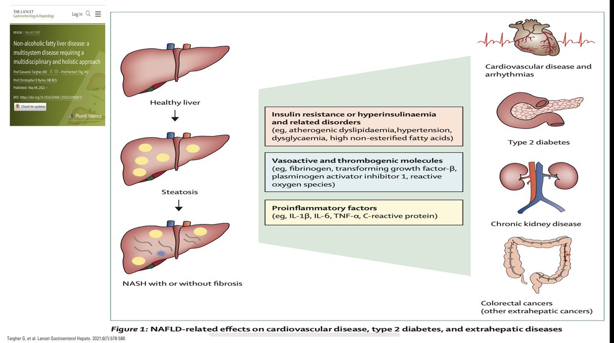 CristobMorales's tweet image. id.elsevier.com/ACW/?return=ht… MAFLD o Enfermedad Hepática Metabólica una epidemia oculta en nuestras consultas, una enfermedad sistémica que requiere un abordaje holístico y multidisciplinar @sepdigestiva @mromerogomez @Dr_ACaballero_ @Dr_Ampuero @fjavesc @DrTinahones @amarcomar