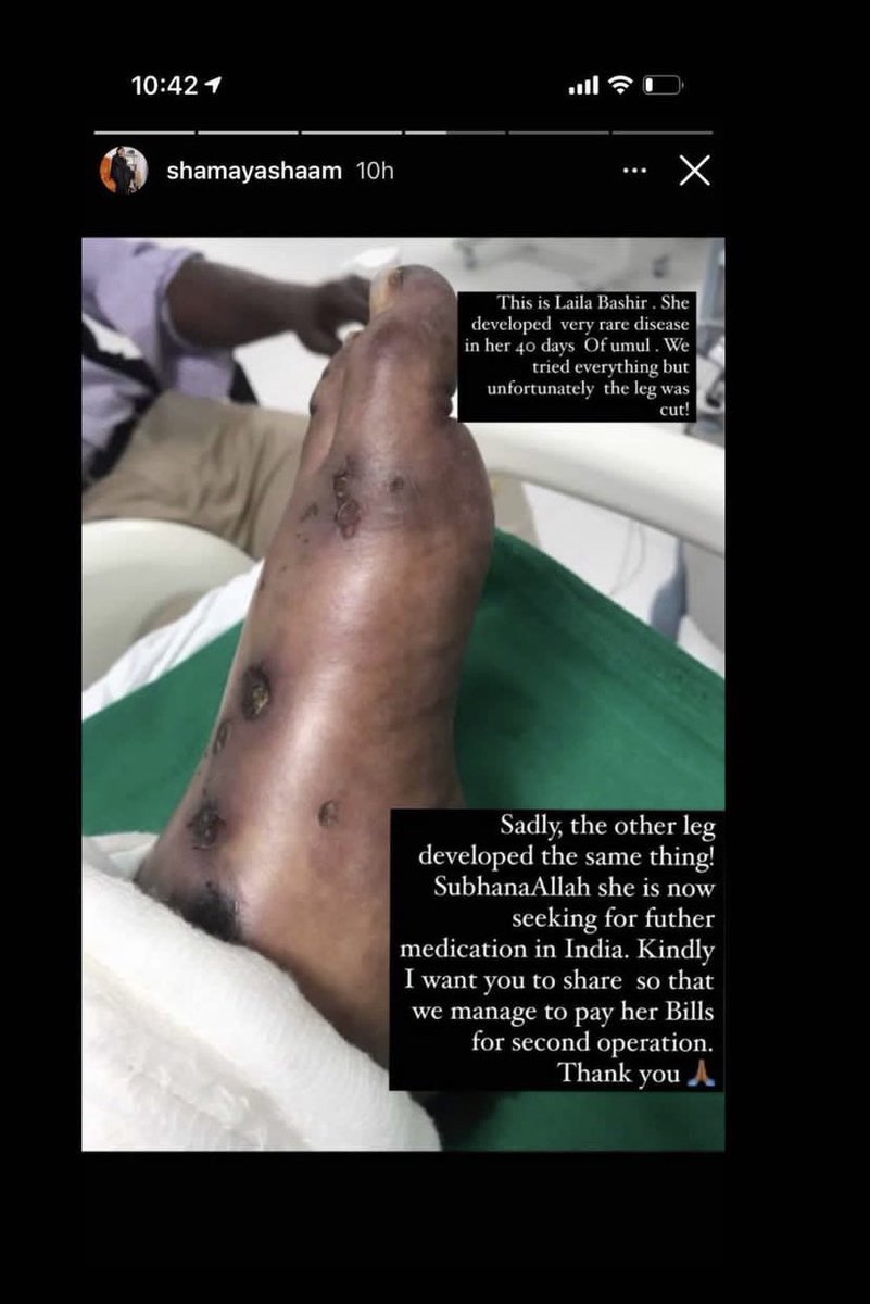 empress_fify's tweet photo. I believe the world is one big family, and we need to help each other. 
May we all come together and help one of us get medical assistance. No amount is less.
Phone number - +254722157570 https://t.co/1VSaUzCt5b