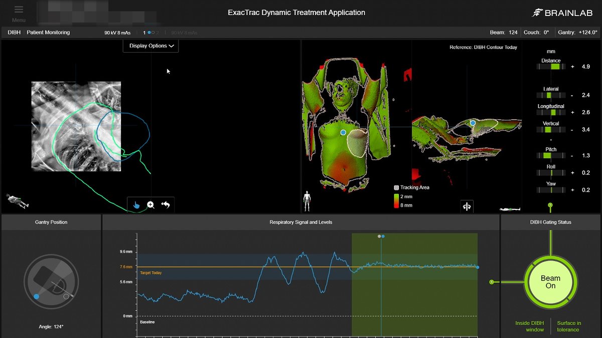 Brainlab tweet media