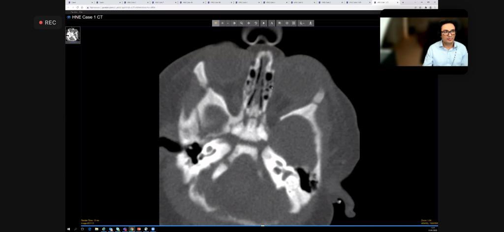 Lalani Carlton Jones tweet media