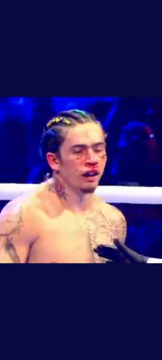 RamonFerretti's tweet photo. "Deu pau no Windows" #boxnocombate https://t.co/RQ2QjSU7TA