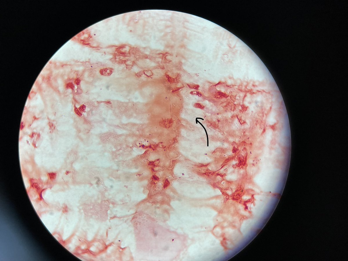 TwoHoneybun's tweet photo. La Microbiología no es solo lo que se ve microscópicamente: también es lo que NO se ve. 👻 “Bacilo Fantasma” o “Bacilo de Koch” son nombres bajo los que se conoce a Mycobacterium tuberculosis 🦠 (contención BSL-3 ⚠️). https://t.co/vWv0djWBYM