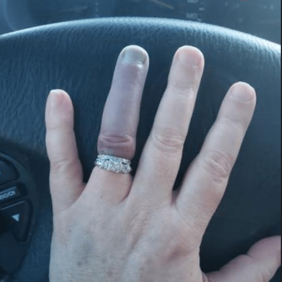 Which finger is the engagement ring worn on?