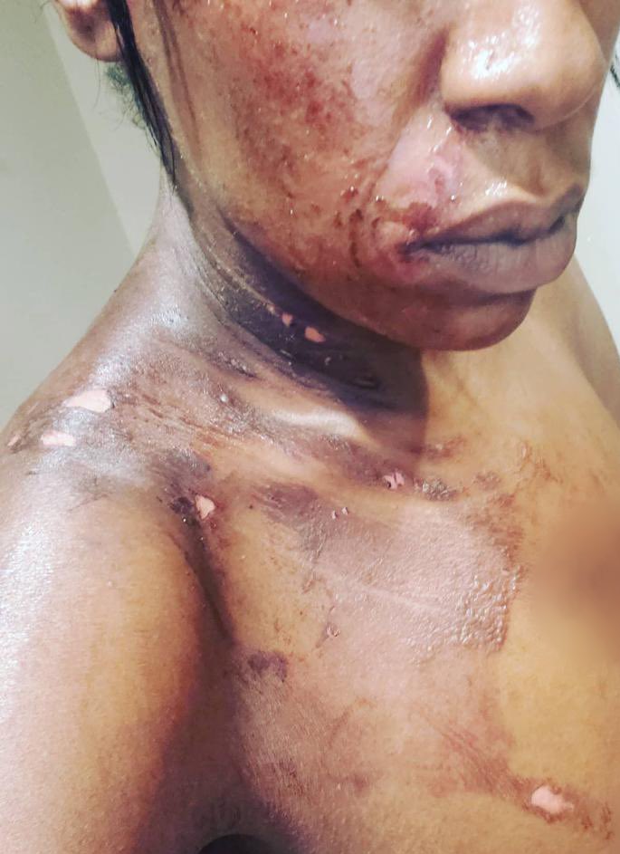 JaneDueker's tweet photo. All photo op no substance. Touting this when this administration is intentionally sending COVID positive violent domestic abusers back into the street is unconscionable. Please respond to the intentionally spreading COVID by City Gov’t. Here is just one victim. #SayNoToDV https://t.co/vya4sg5jad