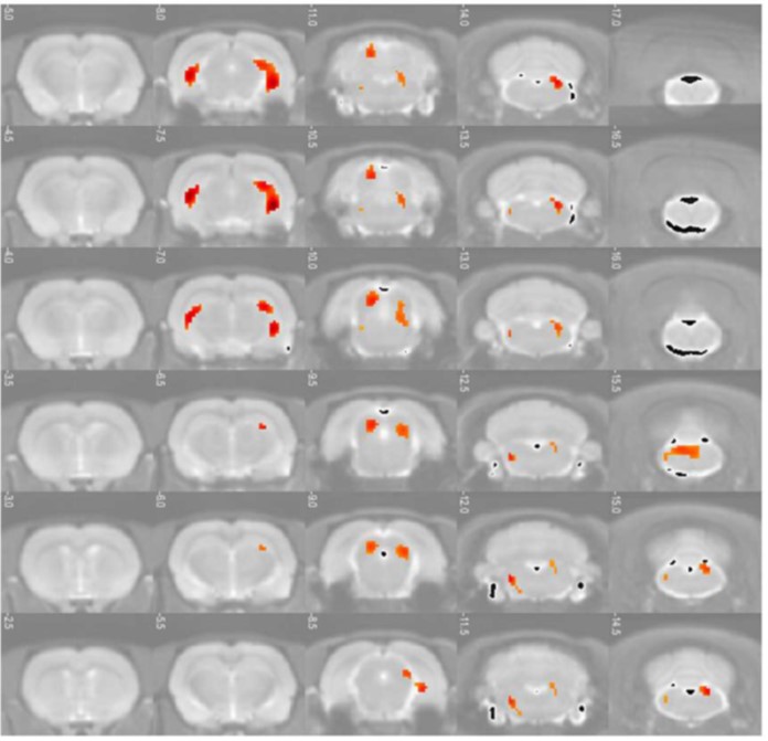 Un miembro de nuestra unidad ha defendido su #TFM sobre los estudios de #neuroimagen por mapas de estadística paramétrica en opiáceos en comparación con los estudios por imagen clásicos usando imágenes obtenidas con el radiotrazador [18F] FDG  #drugs <a href="/UNED/">UNED</a> <a href="/UOCuniversidad/">UOCuniversidad</a>