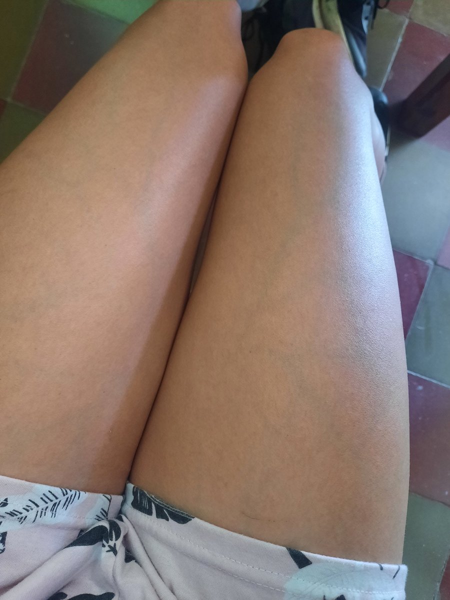 Dice mi novio que le gustan mis venas porque parezco una hojita 🟢🏳