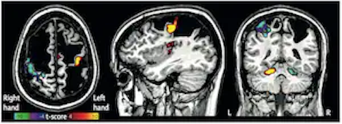 WashU Medicine Mallinckrodt Institute of Radiology tweet media
