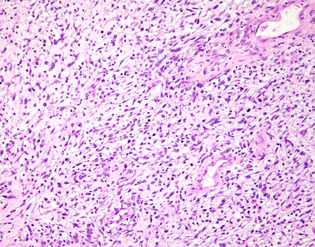 Brigham and Women's Pathology tweet media
