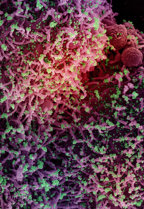 CIDRAP's tweet photo. Study suggests BA.2 #COVID19 subvariant more contagious

The secondary attack rate was shown higher in Denmark for BA.2 than the original Omicron variant—39% vs 29%

https://t.co/uj2OQeDbCJ https://t.co/4Z0TNjqb5J