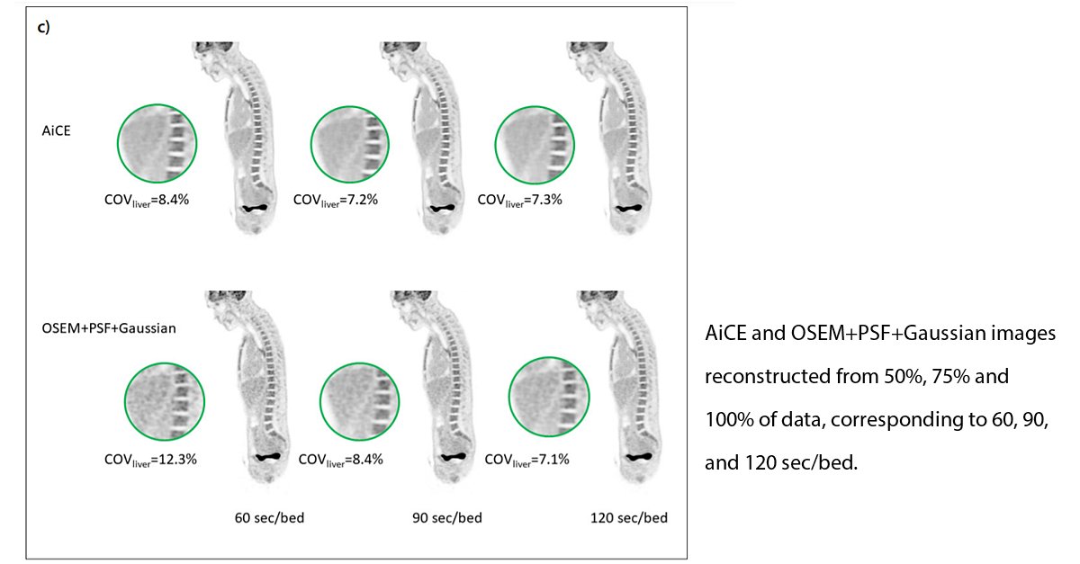 CanonMedicalANZ's tweet image. AiCE, Canon's advanced #DeepLearningReconstruction technology, is now available on the Cartesion Prime, the first completely air-cooled digital PET-CT system. 

Find out how AI helps reduce scan time per bed and improve #ImageQuality in PET imaging. bit.ly/3IRkq8m