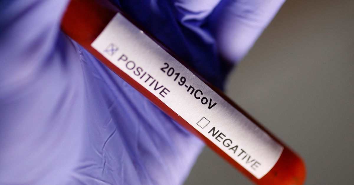 ReutersWorld's tweet photo. Ivermectin shows ‘antiviral effect’ against COVID, Japanese company says https://t.co/Krr9HhPC95 https://t.co/G2aZ8Unr1e