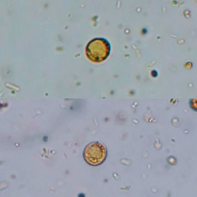 LabClass1206's tweet image. Blastocystis spp. es el protista intracelular que se detecta con mayor frecuencia en muestras de materia fecal humana; las tasas de infección pueden superar el 20% en países en vías de desarrollo. Este parásito en heces de diversas especies animales sugiere su potencial zoonótico