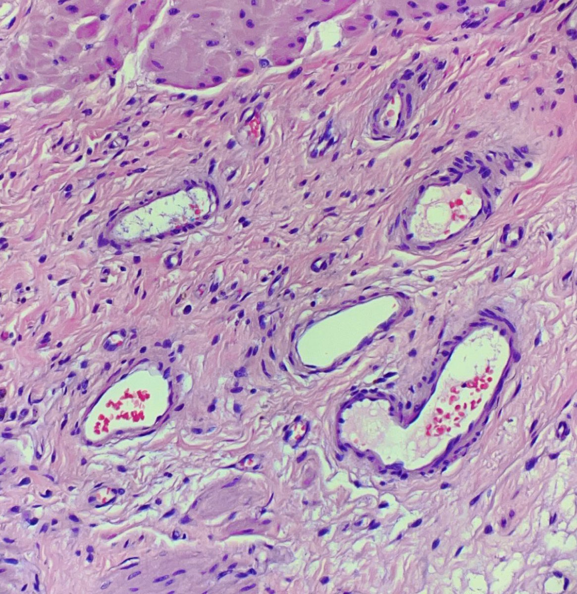 Hansalah's tweet photo. Sending some πβ€οΈπ to your timeline #PathArt #PathHeart https://t.co/FcmoIySsXi