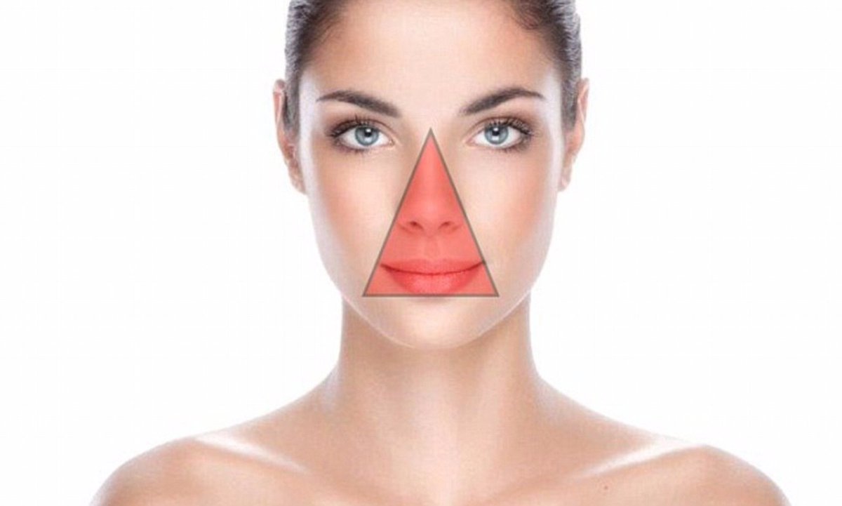 Do not pop pimples in this area around your nose and mouth. This is called the danger triangle and contains blood vessels that connect to the skull and brain. Breaking the skin exposes these vessels to microbes which can travel to the brain and cause complications. Good morning.