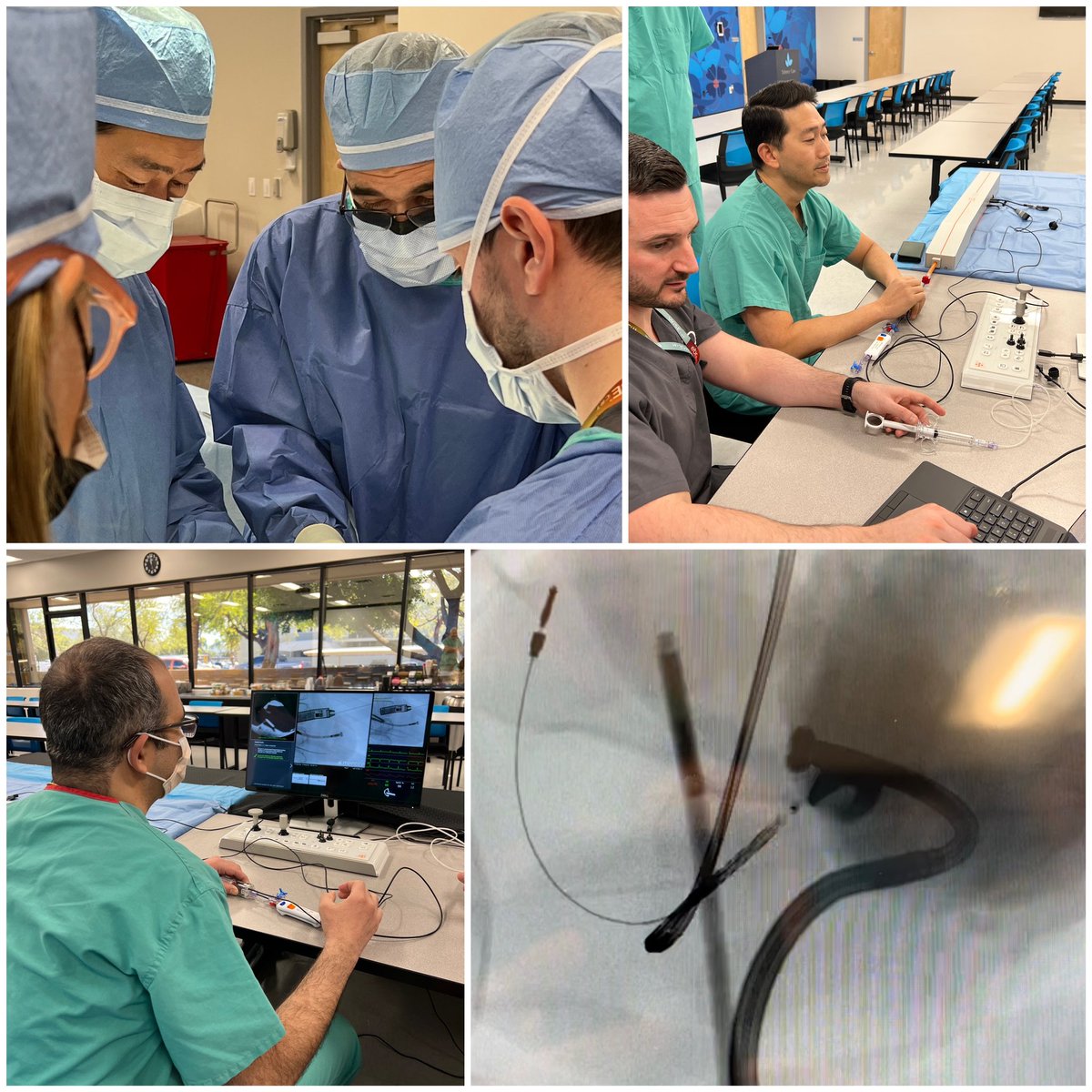 Thank you to @EBRSystemsInc for wonderful learning and training session with myself and @DrRoderickTung today on the WiSE Leadless CRT system. Looking forward to participating in SOLVE-CRT @uazmedphx @BannerHealth and future collaboration!