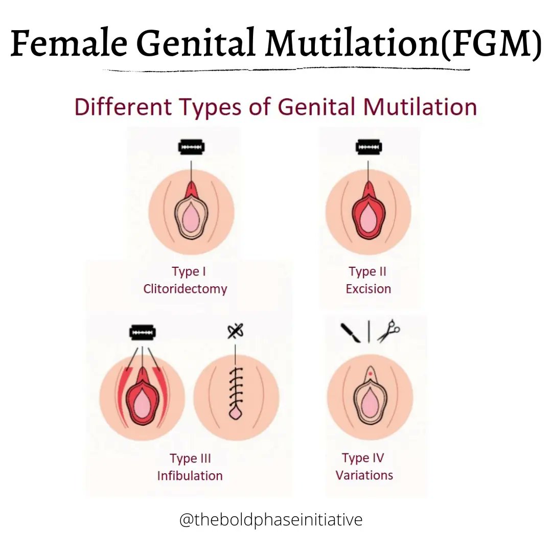theboldphase's tweet photo. Hey guys, join us this week as we take a closer look at #fgm 👣
First of, did you know there are 4 different types of FGM? Swipe to learn more.
#fgmawareness #endfgm #mhm #theboldphase #periodpositive https://t.co/bgs8DqaMxu