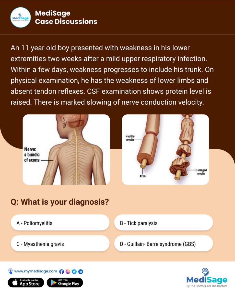 medisage's tweet photo. An 11 year old boy presented with weakness in his lower extremities. Can you diagnose this case?

Click link: https://t.co/ohHwiPGUsJ https://t.co/FjtoX0zzxp