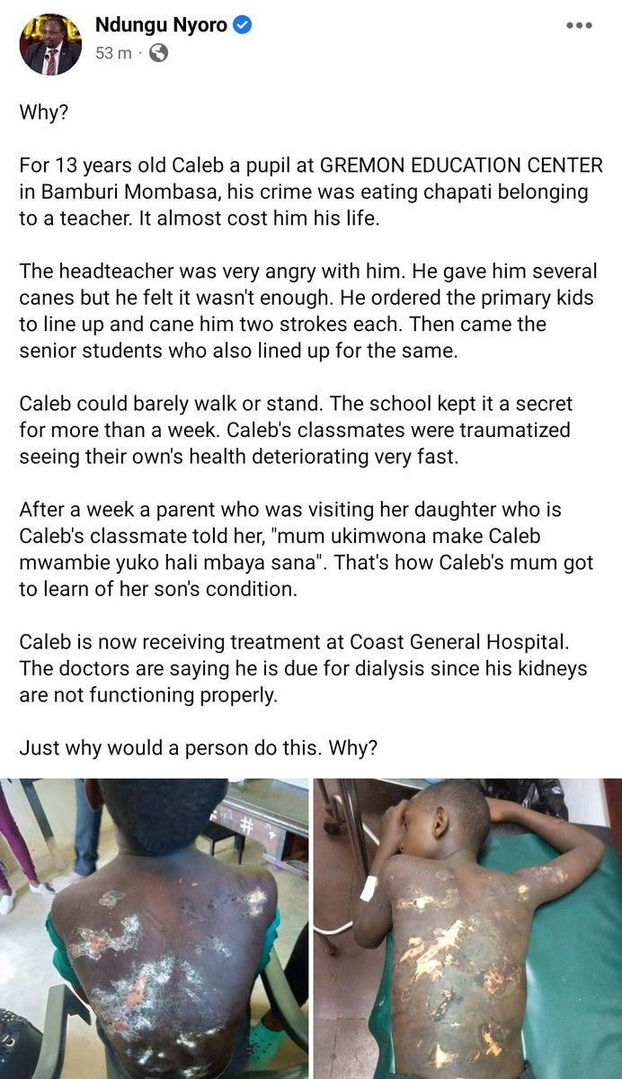 jim_munene's tweet photo. There is this story on Ndungu Nyoro's FB page that's just beyond sad.Maybe check it out,a teacher had a pupil beat up so badly just because he ate his chapati.#AzimioMtaaniNyandarua #UPYAmovement #EarthquakeInNairobi Flaqo Meru #StoryZaKanairo https://t.co/MhpafUKa6H
