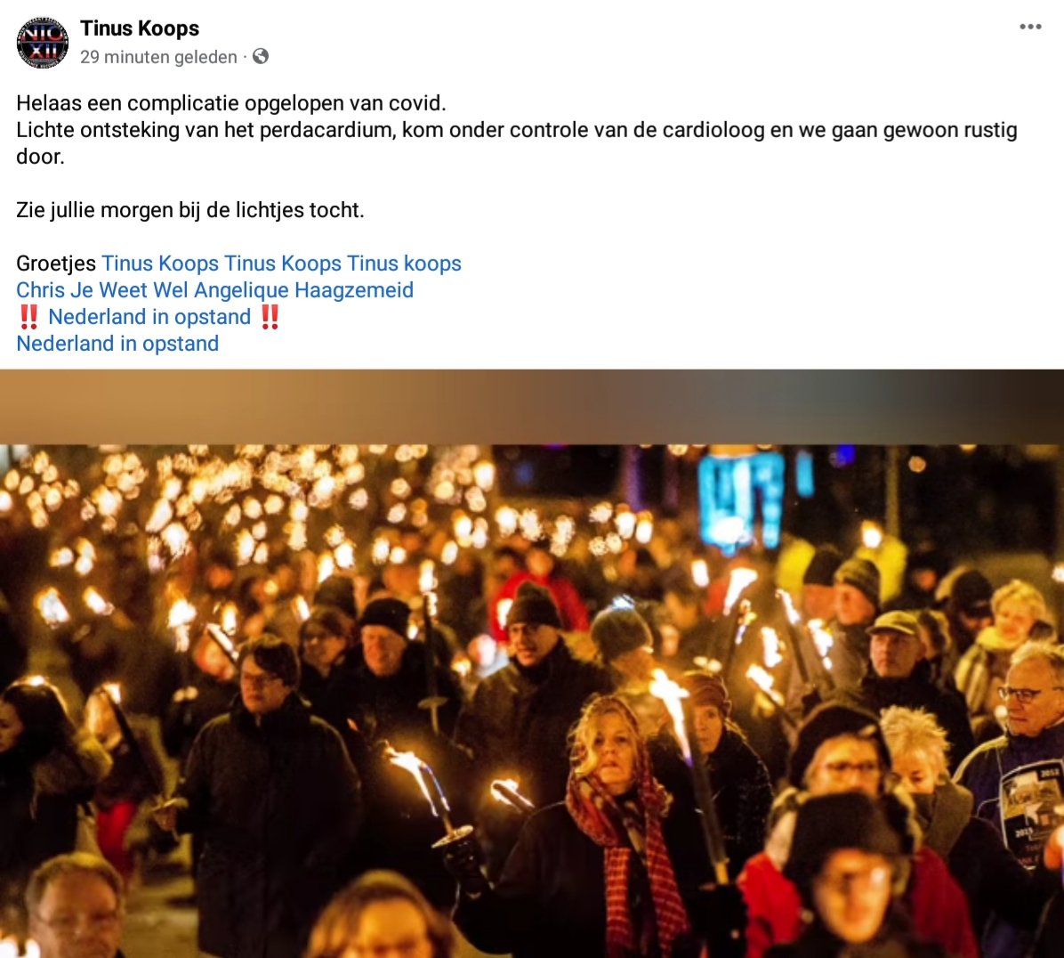 YvonneHoogendi2's tweet photo. Tinus Koops heeft een ontsteking van het hartzakje (pericardium). Pijnlijk maar niet gevaarlijk.
#COVID19NL #COVID19 #TinusKoops @KoopsTinus https://t.co/czgFmEKcL3