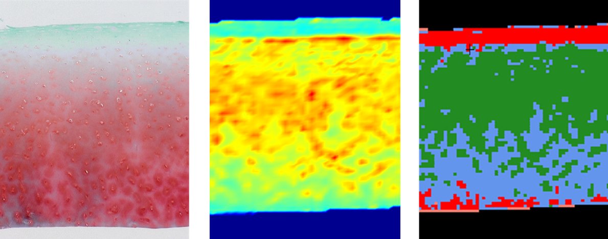 Biocompatibility & Implant Pathology Lab (@rushimplantlab) on Twitter photo Our team has so much to present at #ORS2022. Check out our late breaking poster (#2124) on #FTIR chemical imaging of articular #cartilage during Poster Session 1! @cthrnyz <a href="/RushMedical/">Rush University System for Health</a> <a href="/ORSsociety/">Orthopaedic Research Society</a> #osteoarthritis #orthoreserach #orthopedics #orthotwitter #academictwitter Our team has so much to present at #ORS2022. Check out our late breaking poster (#2124) on #FTIR chemical imaging of articular #cartilage during Poster Session 1! @cthrnyz <a href="/RushMedical/">Rush University System for Health</a> <a href="/ORSsociety/">Orthopaedic Research Society</a> #osteoarthritis #orthoreserach #orthopedics #orthotwitter #academictwitter