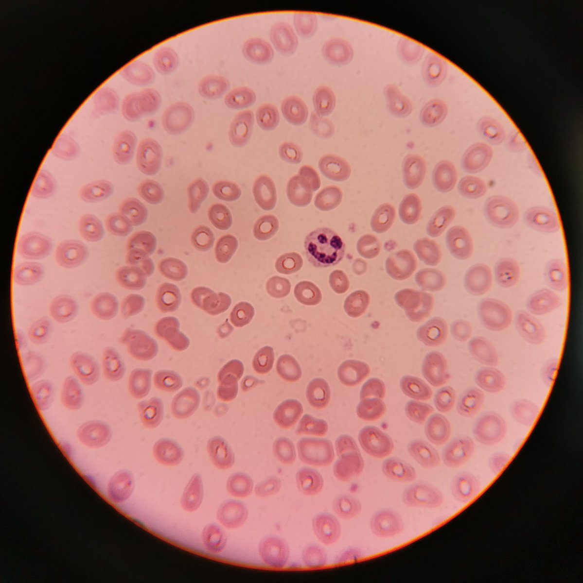 aelinren's tweet image. daj rt temu usmiechnietemu neutrofilkowi a zdasz sesje w pierwszym terminie