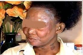 NIOXORLEE's tweet photo. Pour célébrer 20 ans de lutte contre les méfaits de la dépigmentation artificielle,
Allô docteur reçoit ce mardi à 19h, Pr Fatimata Ly, présidente de AIIDA
#kebetu
#aiida #xeesal @PourCoalition @ASPSP4
@lsidibe76 @AIIDA_SN
@ligueblogsante https://t.co/7JsRZWIX37