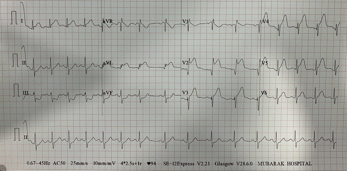 ECGs tweet media