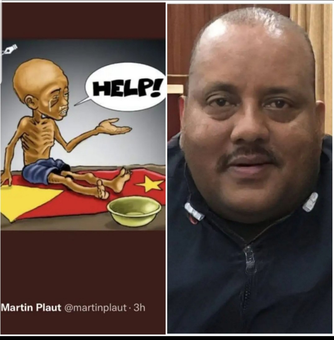 The only place we can get two extremes of nutritional problem is Tigray
#NoMore 
#AfarGenocide