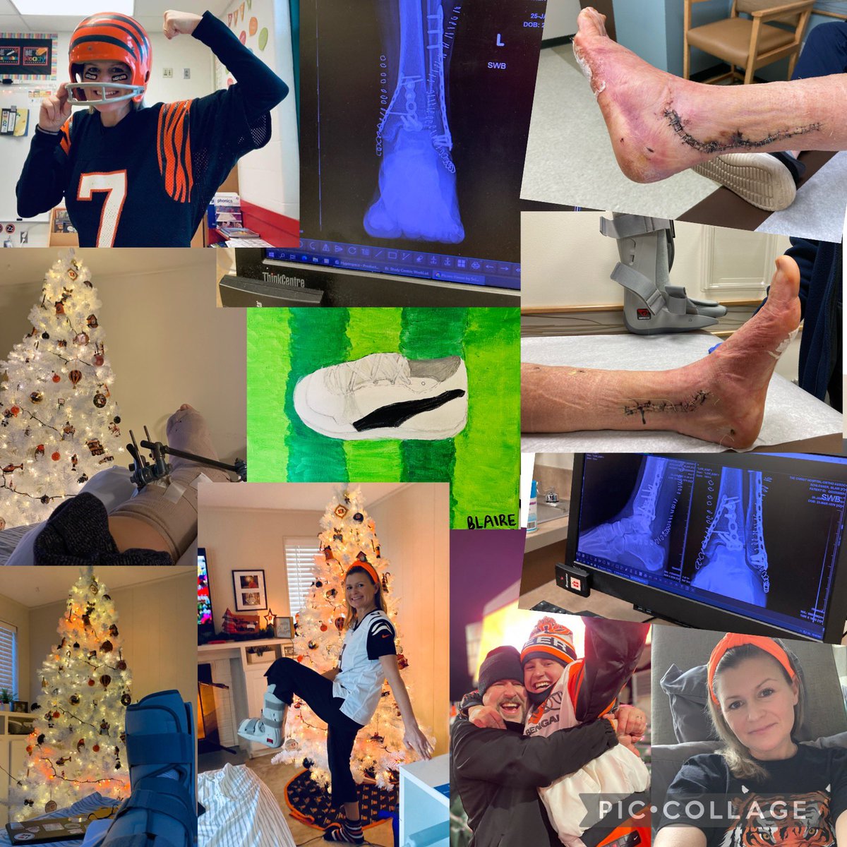 ***SUPER FAN Husband &amp; Wife***
Die hard since Day 1…Family all in. Never missed a home game at PBS. Season ticket holders, Artist, Bengals truck, Bengals basement…Wife injured CHEERING at 12/26 Ravens win. Hardware to prove. Bengals haven’t lost since #truefans #WHODEY 🐯