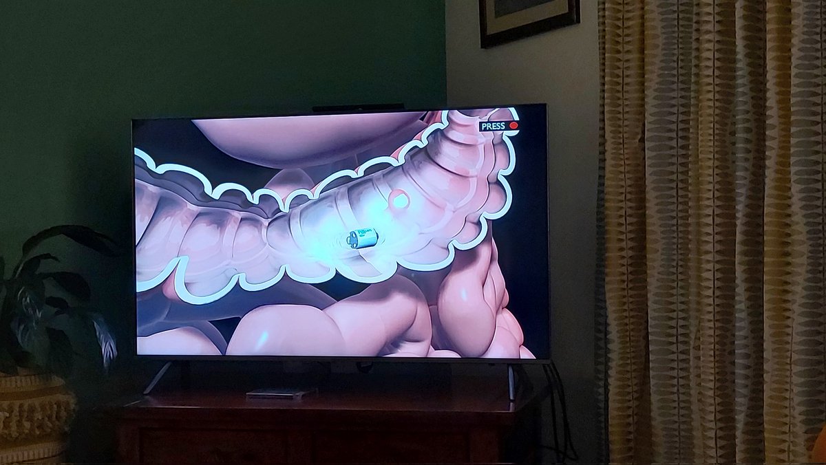 Watching Reporting Scotland teatime news &amp; delighted to see positive coverage of Pillcam Project!🤗 Great to see early <a href="/dhiscotland/">Digital Health & Care Innovation Centre (DHI)</a> collaborative, innovation project rolling out across Scotland. <a href="/Watsoninverness/">Angus J Mackintosh Watson</a> @brendanf_nss <a href="/michelle_dhi/">Michelle Brogan</a> <a href="/NHSScotCfSD/">Centre for Sustainable Delivery</a> <a href="/roma_maguire/">Prof Roma Maguire MBE</a>