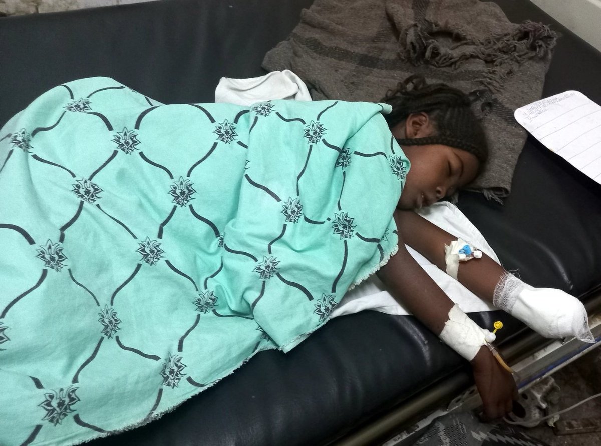 AbuHayd28175879's tweet photo. #AfarUnderAttack
This child needs to be transferred to best available hospital in order to undergo emergency treatment for shrapnel wounds in her head &amp; eyes. Please retweet Max
@AbiyAhmedAli @FMoHealth @AfarWatch 😭😭 https://t.co/QIlRlquRpB https://t.co/giFwQnPhvY