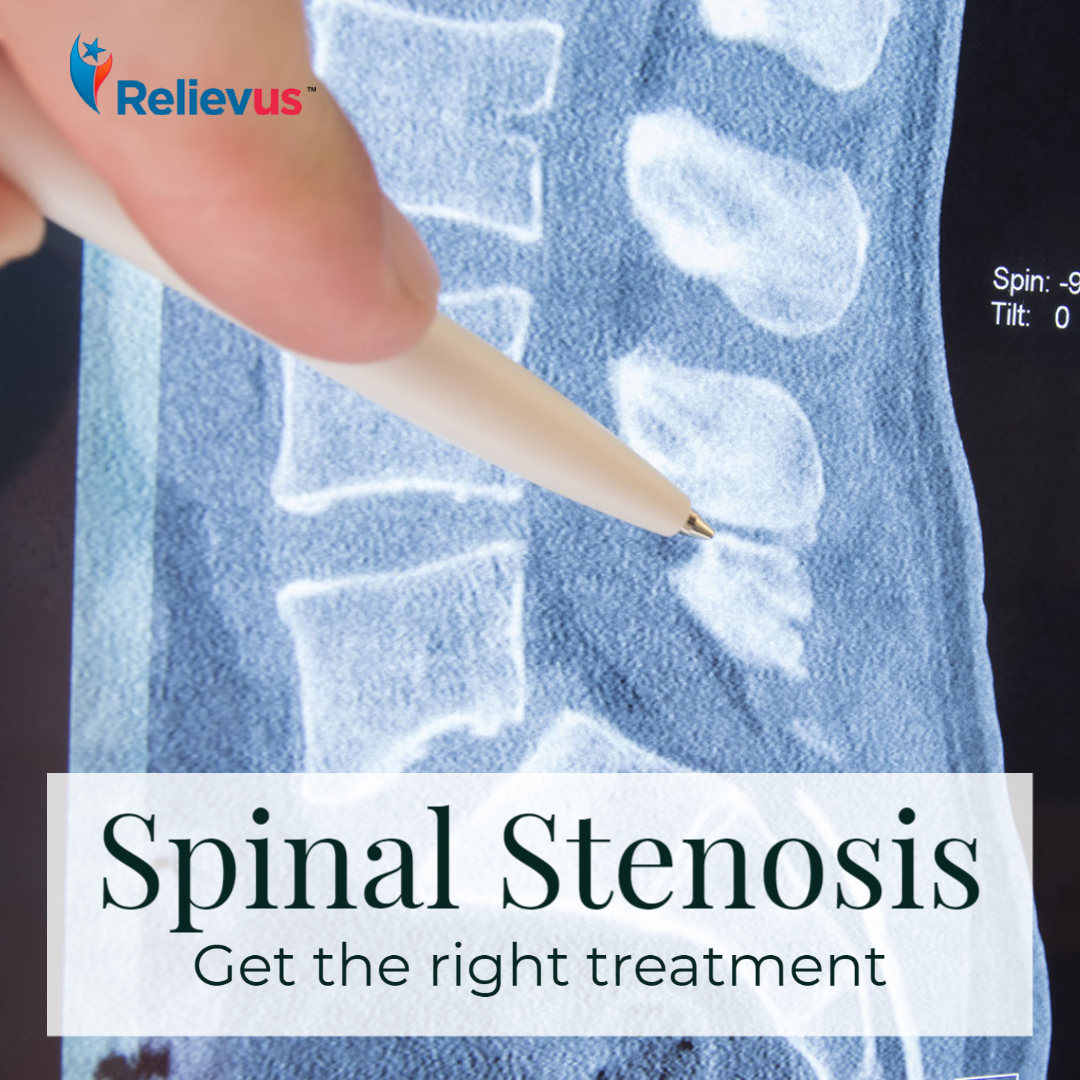 Relievus's tweet image. Spinal stenosis is a condition that causes the spinal canal, or other vertebrae openings, to narrow and compress the spinal cord or other nerves.

relievus.com/conditionsands…

#backproblem #backpain #spinalstenosis #stenosis #spineinjury #painrelief #relievus #relievepain #feelbetter