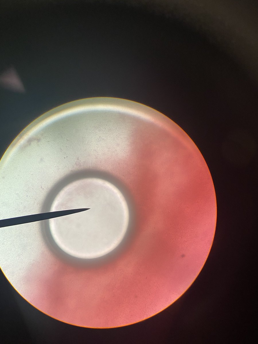 i3comm's tweet photo. When you look at your bacteria specimen under a microscope and you see this. What in the world?! #pokemon #Science #pokescience https://t.co/x7FeSptq8r