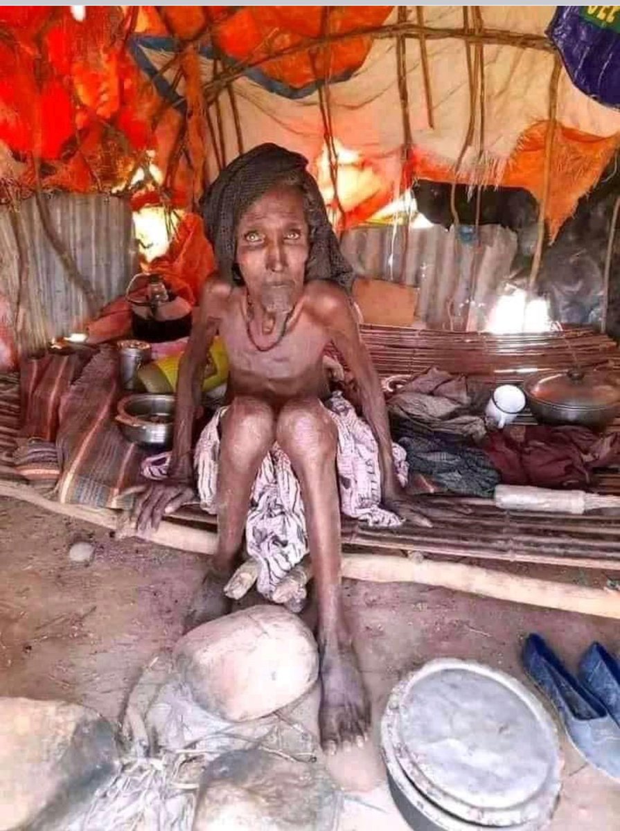 theoromiadailyp's tweet photo. What happened in #Booranaa a while ago is now happening in Balee! Balee was a breadbasket for our nation and they are suffering now. Please find a connection and extend your helping hands! #Balee https://t.co/YGywbD01CA