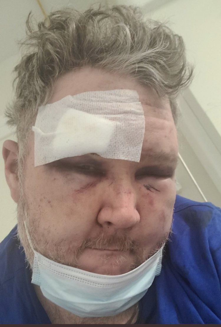 cadcomputersTV's tweet photo. “I’m blessed”
#ralphretort
#deadweightgunt
#jimlives https://t.co/iSE4EcAkRG