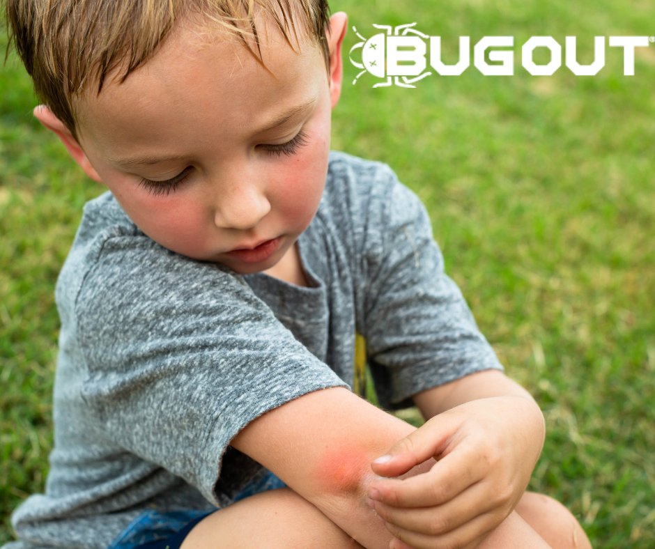 BugOut_Service's tweet image. What bit me? Click below for common bug bites and ways to treat them!

Need pest control services? Visit bugoutservice.com NOW!

Article: medicalnewstoday.com/articles/ident…