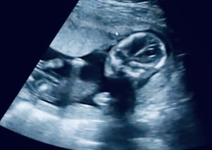 妊娠１５週 Twitter Search Twitter