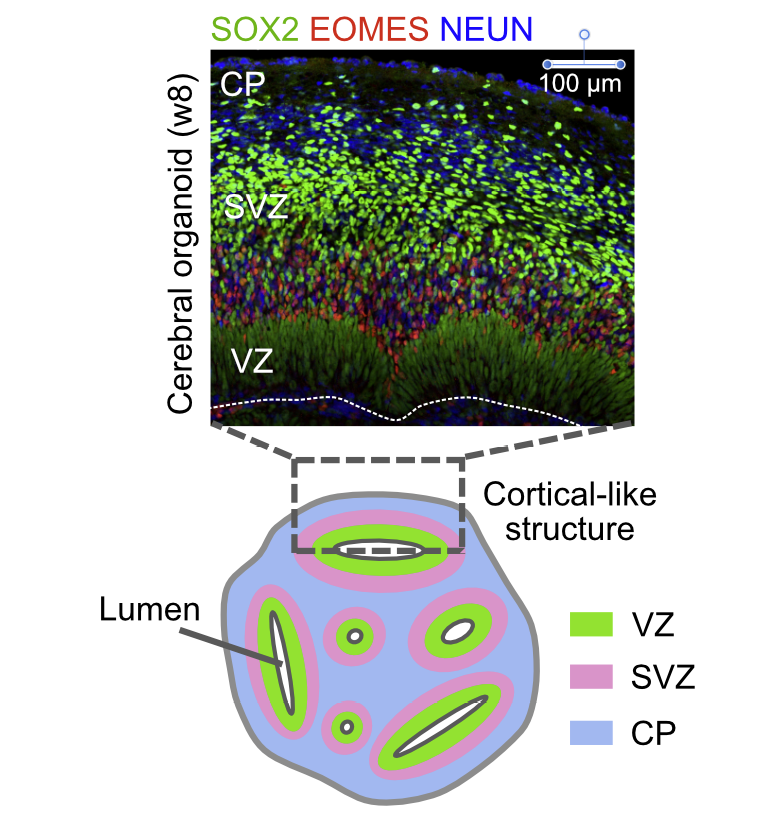 ✌️Finally out! We are so excited to release our cell fate decision map in the human developing neocortex. Performed in fetal tissu and organoids using correlative imaging. A🧵 biorxiv.org/content/10.110… @Inserm @institut_curie @CNRS @AgenceRecherche