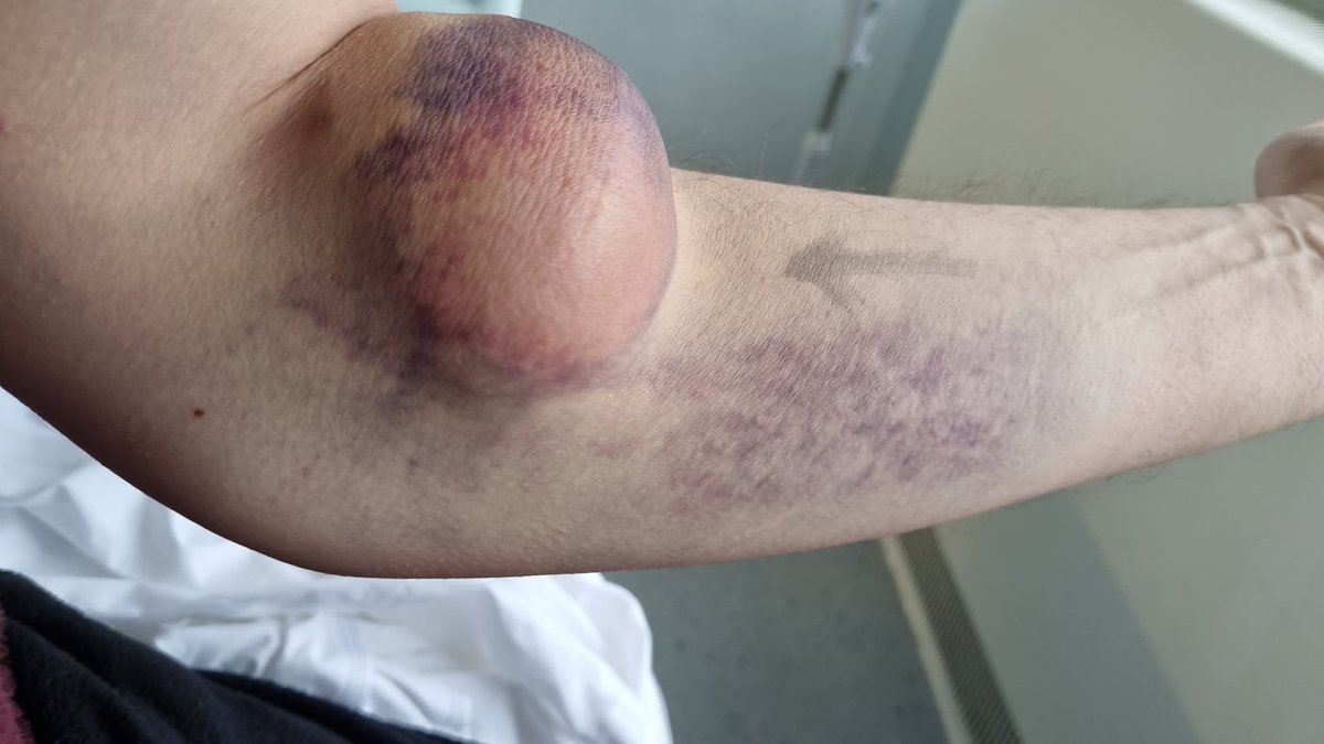 Mark Ruston tweet media