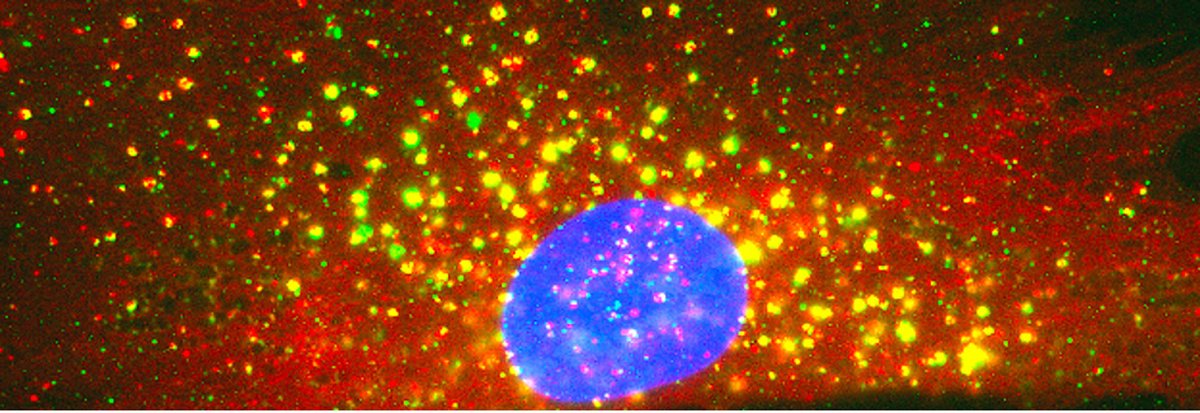 IGBMC (@igbmc) on Twitter photo 2⃣ Post-doc positions are available in <a href="/jocelyn_laporte/">laporte jocelyn</a>'s team which focus on neuromuscular pathologies! If you are interested in doing research on #myopathy or membrane remodelling, check them!
👉All the team's research and the two job offers here : bit.ly/3AQmP09 2⃣ Post-doc positions are available in <a href="/jocelyn_laporte/">laporte jocelyn</a>'s team which focus on neuromuscular pathologies! If you are interested in doing research on #myopathy or membrane remodelling, check them!
👉All the team's research and the two job offers here : bit.ly/3AQmP09