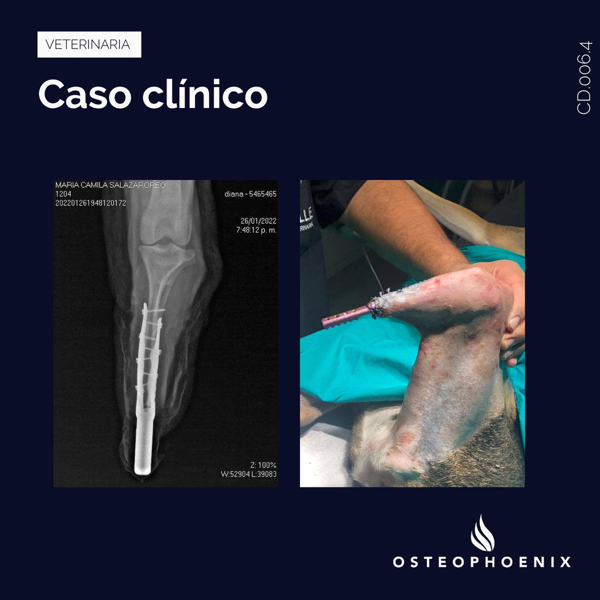 OsteophoenixSL's tweet photo. Reconstrucción total de una de las extremidades inferiores de Oreo, un perro de tamaño medio. El equipo de Osteophoenix ha diseñado y fabricado una prótesis totalmente a medida utilizando la impresión 3D en titanio. En las fotos podemos ver los resultados.
https://t.co/9kD6vsLcg0 https://t.co/3SnDjaFVQm