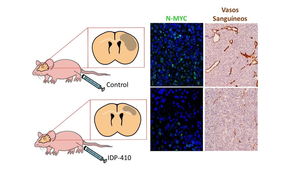 📍 Una investigación del #ISCIII en colaboración con el Hospital 12 de Octubre de Madrid e IDP Pharma ha logrado avances in vitro y en modelo animal contra los glioblastomas, los tumores cerebrales más comunes.

📰 Más información en #NoticiasISCIII ➡️ bit.ly/3oicwgr