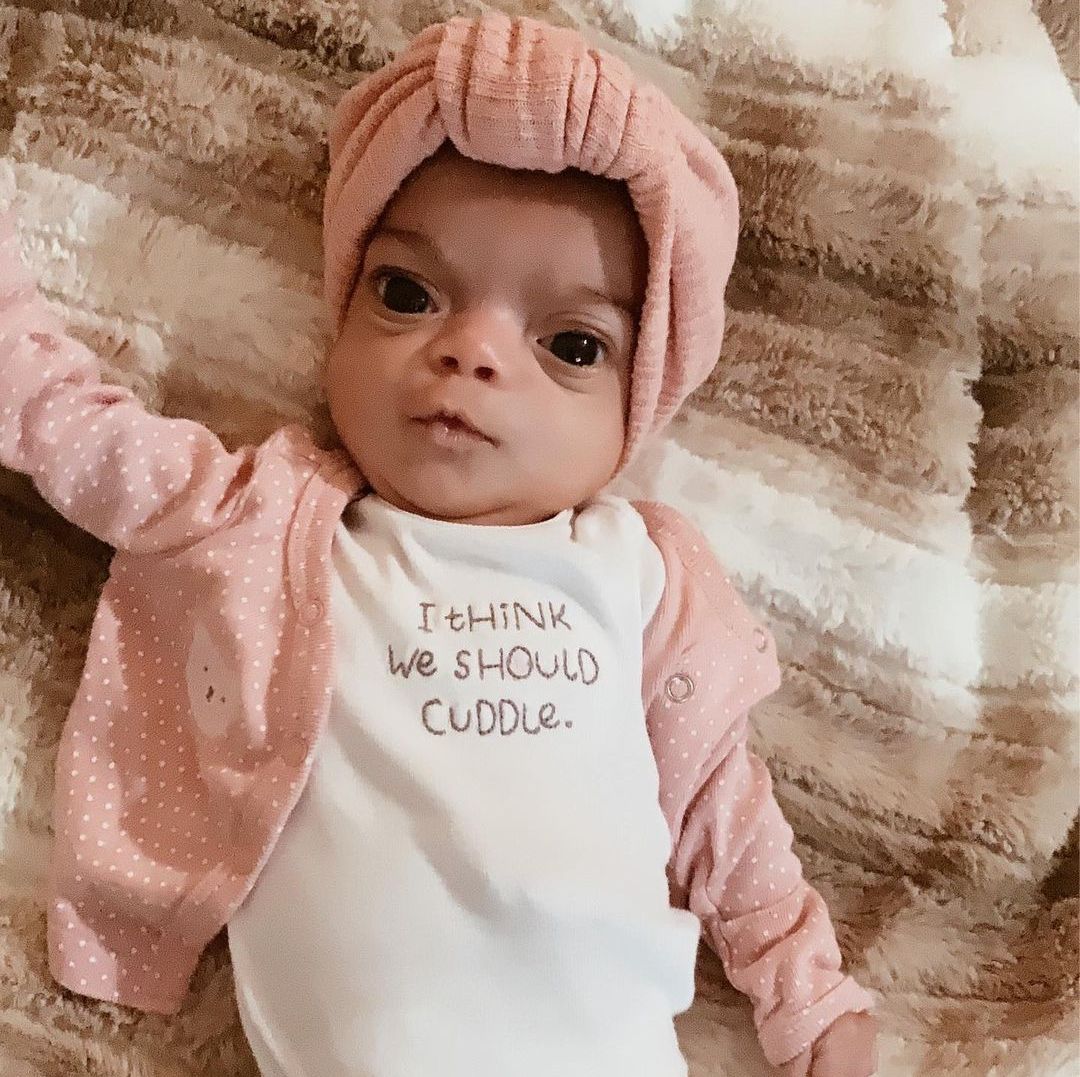 orlandohealth's tweet photo. Comment with a heart to show your support for this strong baby. ❤️  Mila had heart surgery at just 11 days old, due to coarctation of aorta and a ventricular septal defect. She spent 2 months in @WinnieHospital's NICU. 
#HeartMonth #MyWinnieBaby #ChooseOrlandoHealth https://t.co/aT1kxHOTYb