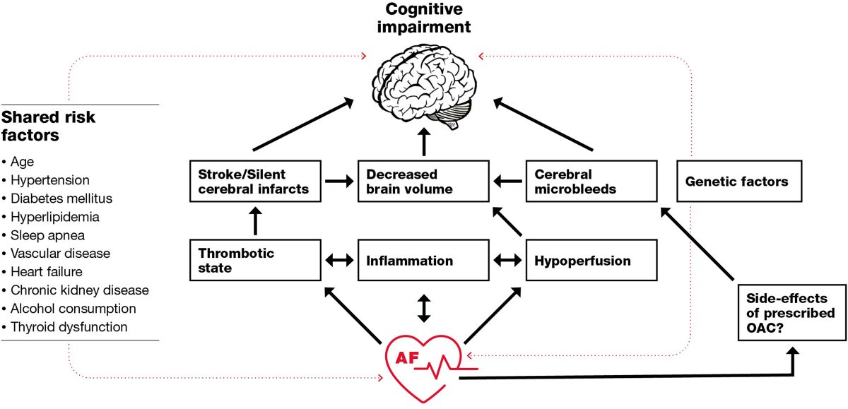 AFib Emory (@afib_emory) on Twitter photo Just published in <a href="/CircAHA/">Circulation</a>, a fantastic review on the link between #AFib and #dementia, providing directions for further research on the area ahajournals.org/doi/10.1161/CI… Just published in <a href="/CircAHA/">Circulation</a>, a fantastic review on the link between #AFib and #dementia, providing directions for further research on the area ahajournals.org/doi/10.1161/CI…