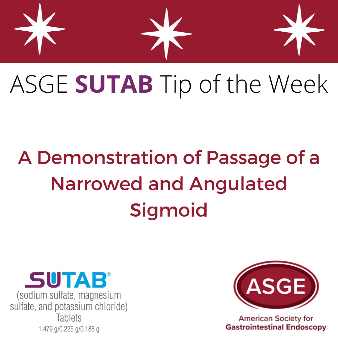 ASGEendoscopy's tweet photo. NEW #SUTAB Tip of the Week! #ASGE President @Rex_colonoscopy demonstrates passage of a narrowed and angulated sigmoid. Enjoy the full library of short #colonoscopy resources! https://t.co/VHardiqHic #Endoscopy #CRC #Healthcare #GeneralEndoscopy #AdvancedEndoscopy https://t.co/80E0LPxlM4