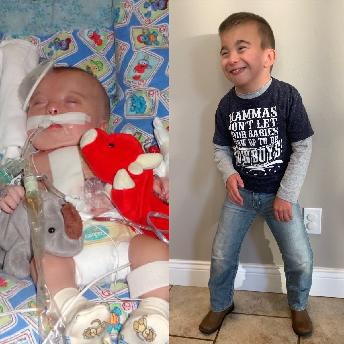 Gavin had open heart surgery for a heart defect. CHD is #1 birth defect in the US with no cure. Surgery can correct some of the problems but there can be lifelong heart problems #rockyourscar #chdawareness #heartwarrior #1in100 #hearthealth #februaryisheartmonth @educate_bain